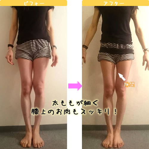 Aさんビフォーアフター