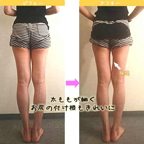 Aさんビフォーアフター写真